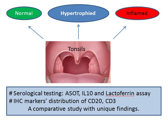 A comparative study of selected immunological markers on children with normal tonsils, simple hypertrophic tonsils, and recurrently inflamed tonsils 