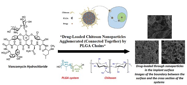 Vancomycin prolonged release via PLGA system loaded with drug-containing chitosan nanoparticles as a novel in situ forming drug delivery system 
